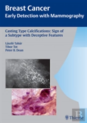 Casting-Type Calcifications: Sign Of A Subtype With Deceptive Features