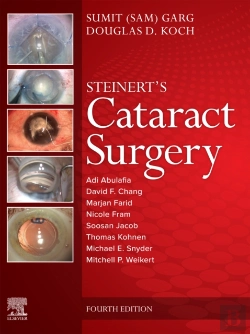 Bertrand.pt - Cataract Surgery