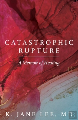 Bertrand.pt - Catastrophic Rupture: A Memoir Of Healin