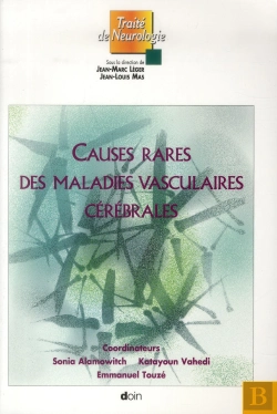 Bertrand.pt - Causes Rares Des Maladies Cerebrovasculaires