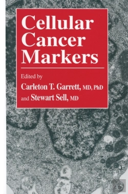 Bertrand.pt - Cellular Cancer Markers