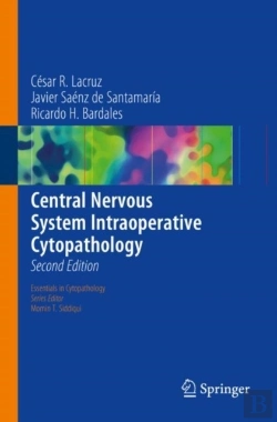 Bertrand.pt - Central Nervous System Intraoperative Cytopathology