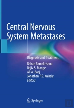 Bertrand.pt - Central Nervous System Metastases