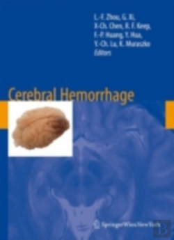 Bertrand.pt - Cerebral Hemorrhage
