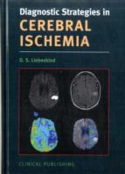 Bertrand.pt - Cerebral Ischemia