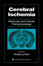 Cerebral Ischemia