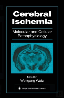 Bertrand.pt - Cerebral Ischemia