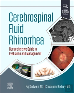 Bertrand.pt - Cerebrospinal Fluid Rhinorrhea