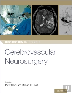 Bertrand.pt - Cerebrovascular Neurosurgery
