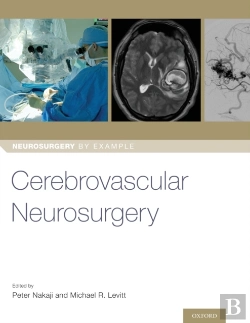 Bertrand.pt - Cerebrovascular Neurosurgery
