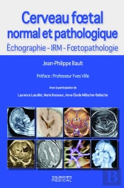 Cerveau Foetal Normal Et Pathologique : Echographie, Irm, Foetopathologie