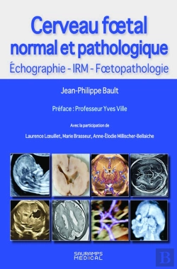 Bertrand.pt - Cerveau Foetal Normal Et Pathologique : Echographie, Irm, Foetopathologie