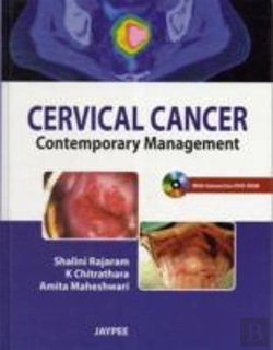 Bertrand.pt - Cervical Cancer