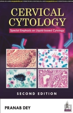 Bertrand.pt - Cervical Cytology