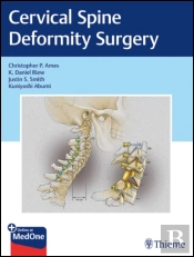 Cervical Spine Deformity Surgery