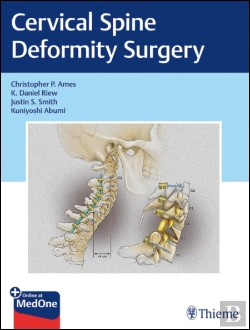 Bertrand.pt - Cervical Spine Deformity Surgery