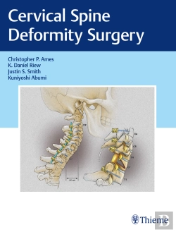 Bertrand.pt - Cervical Spine Deformity Surgery