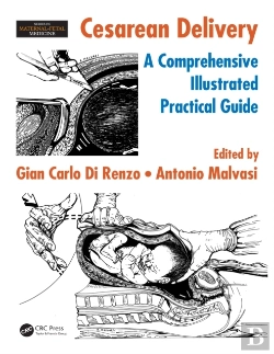 Bertrand.pt - Cesarean Delivery