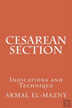 Bertrand.pt - Cesarean Section