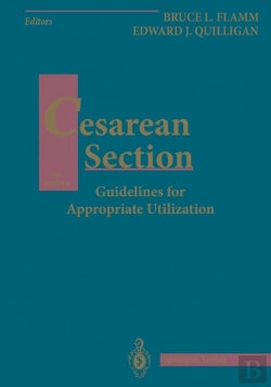 Bertrand.pt - Cesarean Section