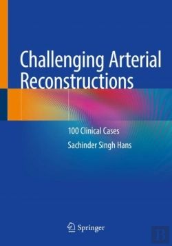 Bertrand.pt - Challenging Arterial Reconstructions