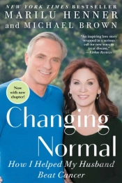 Changing Normal