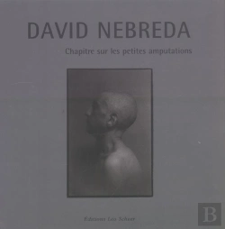 Bertrand.pt - Chapitre Sur Les Petites Amputations