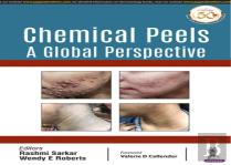 Chemical Peels: A Global Perspective