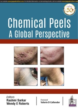 Bertrand.pt - Chemical Peels: A Global Perspective