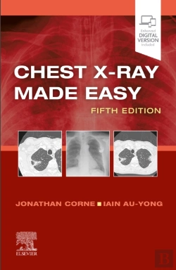 Bertrand.pt - Chest X-Ray Made Easy E-Book