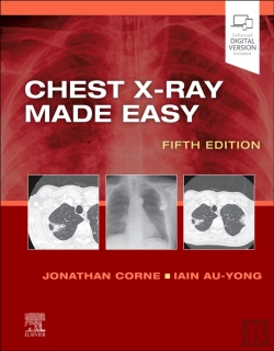 Bertrand.pt - Chest X-Ray Made Easy
