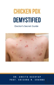 Chickenpox Demystified: Doctor'S Secret Guide
