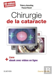 Chirurgie De La Cataracte ; 80 Vidéos Séquencées