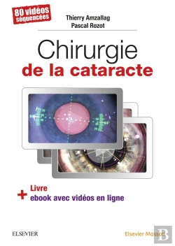 Bertrand.pt - Chirurgie De La Cataracte ; 80 Vidéos Séquencées
