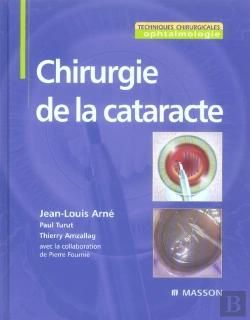 Bertrand.pt - Chirurgie De La Cataracte