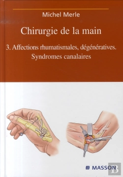 Bertrand.pt - Chirurgie De La Main T.3 ; Affections Rhumatismales, Dégénératives. Syndrome Canalaire
