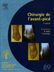 Chirurgie De L'Avant-Pied