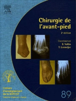 Bertrand.pt - Chirurgie De L'Avant-Pied