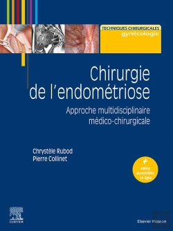 Bertrand.pt - Chirurgie De L'Endometriose