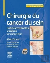 Chirurgie Du Cancer Du Sein