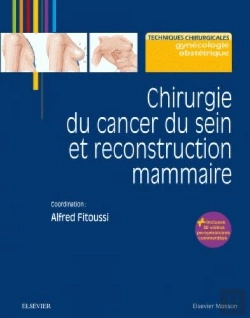 Bertrand.pt - Chirurgie Du Cancer Du Sein Et Reconstruction Mammaire