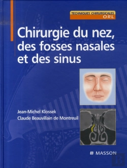 Bertrand.pt - Chirurgie Du Nez, Des Fosses Nasales Et Des Sinus