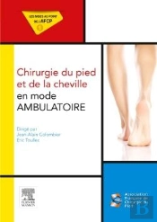 Chirurgie Du Pied Et De La Cheville En Mode Ambulatoire