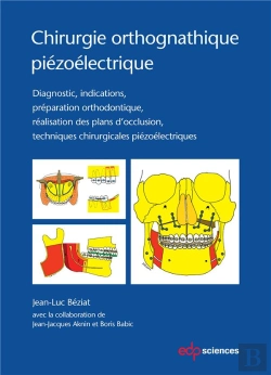 Bertrand.pt - Chirurgie Orthognathique Piézoélectrique