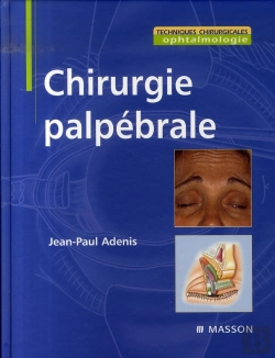 Bertrand.pt - Chirurgie Palpébrale