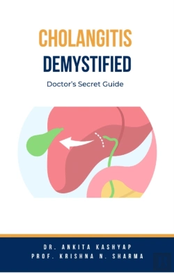 Bertrand.pt - Cholangitis Demystified: Doctor'S Secret Guide