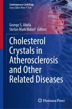Bertrand.pt - Cholesterol Crystals In Atherosclerosis And Other Related Diseases