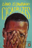 Cicatrizes