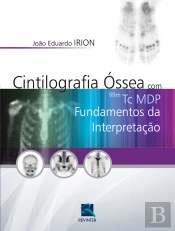 Cintilografia Óssea Com 99mtc Mdp