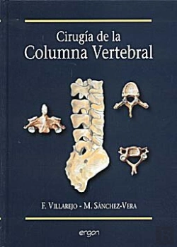 Bertrand.pt - Cirug¡A De La Columna Vertebral